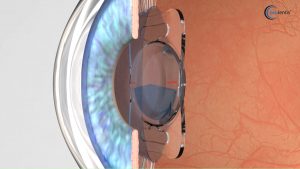 Industrie Animation 17